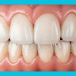 Diş Eti Çekilmesi: En Sık Yapılan Hatalar ve Diş Etlerini Korumak İçin Etkili İpuçları