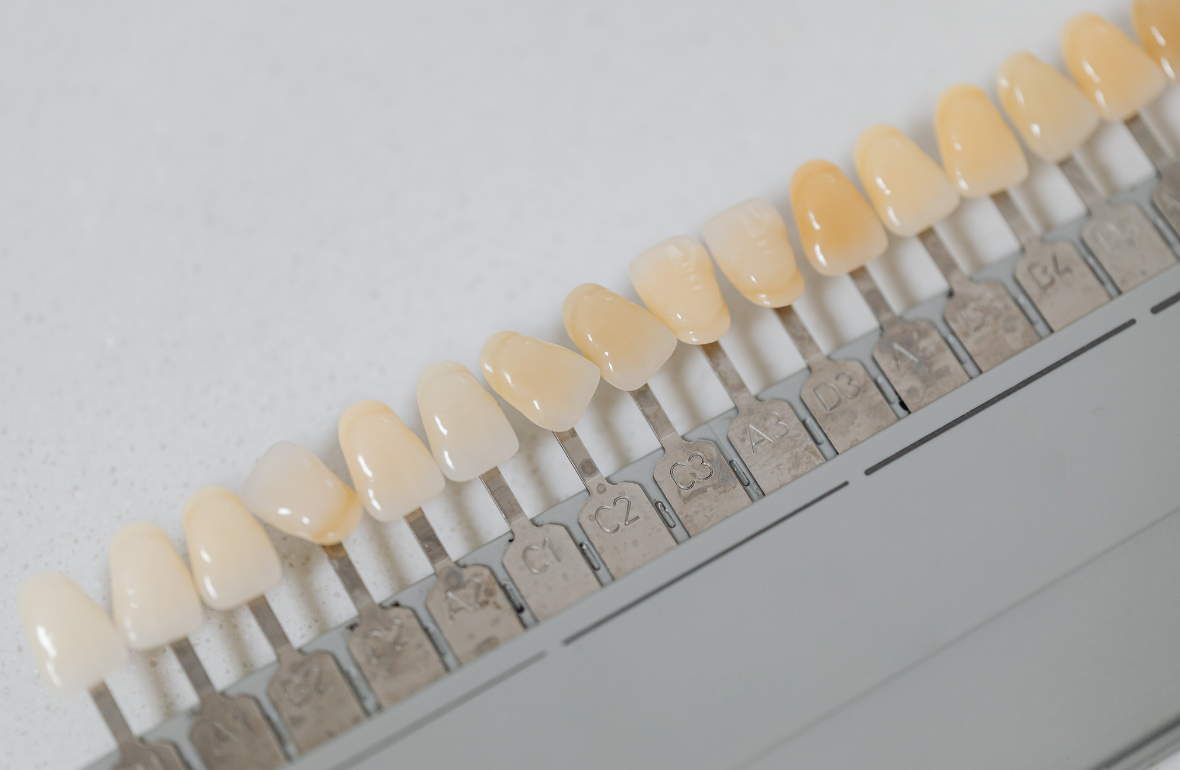 Diş Beyazlatma (Bleaching) Nedir
