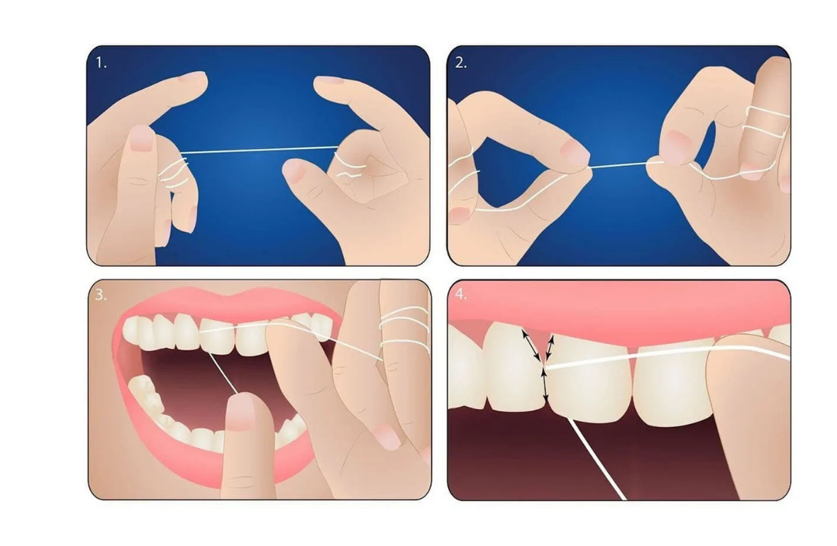 Diş İpi Kullanımı Gerçekten Gerekli mi Nasıl Kullanılır