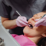 Diş Taşı Nedir Temizlenmezse Ne Olur