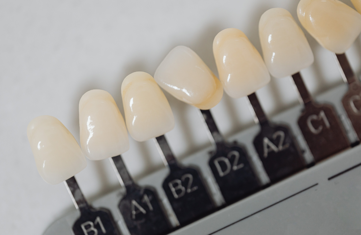 Zirkonyum Kaplama mı Porselen mi? Hangisi Daha İyi?