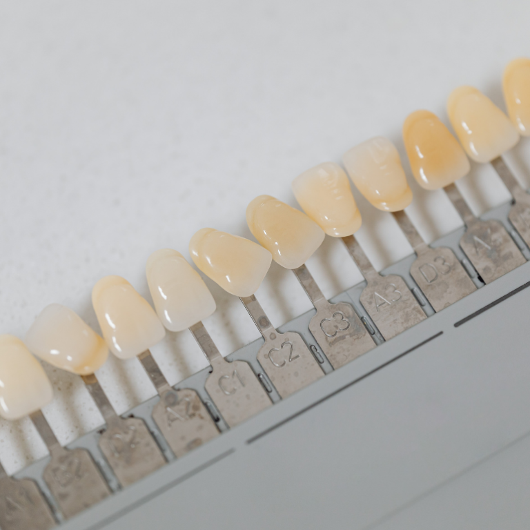 Diş Beyazlatma (Bleaching) Nedir