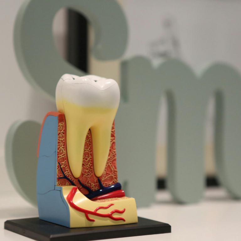 Diş Hassasiyeti: Nedenleri ve Çözüm Önerileri